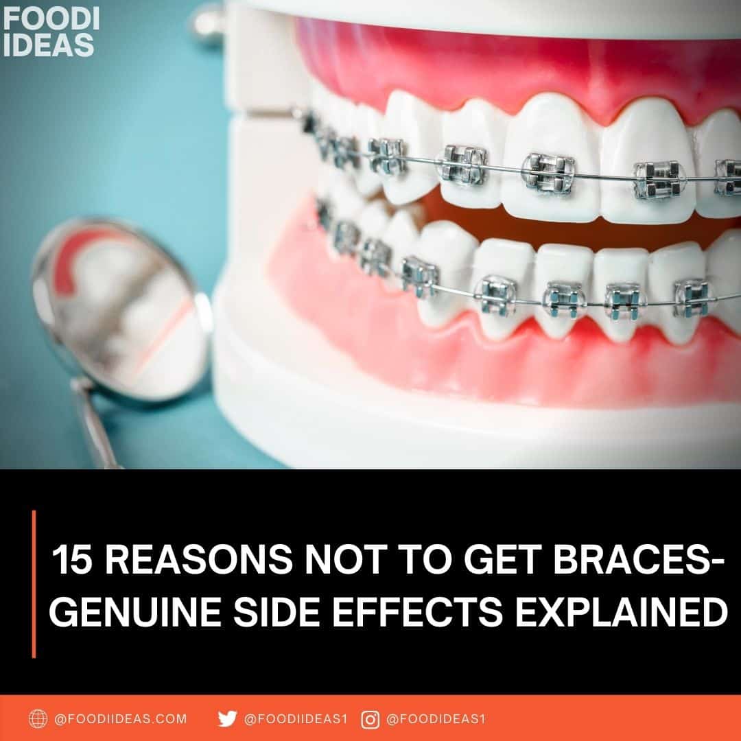 15 Reasons Not To Get Braces Top Side Effects Explained