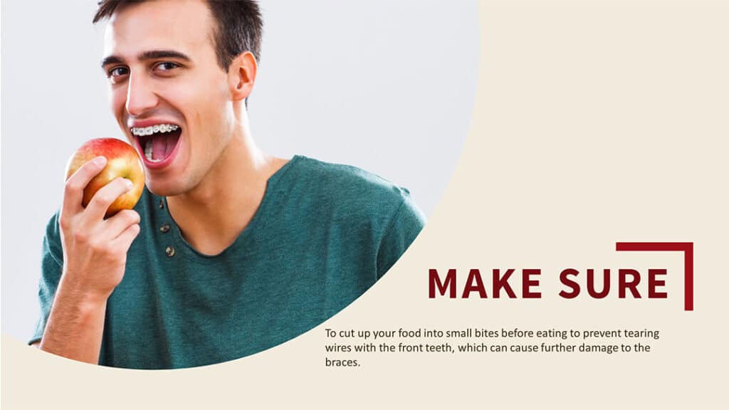 What to Eat with Braces and What Not? A Definitive Guide