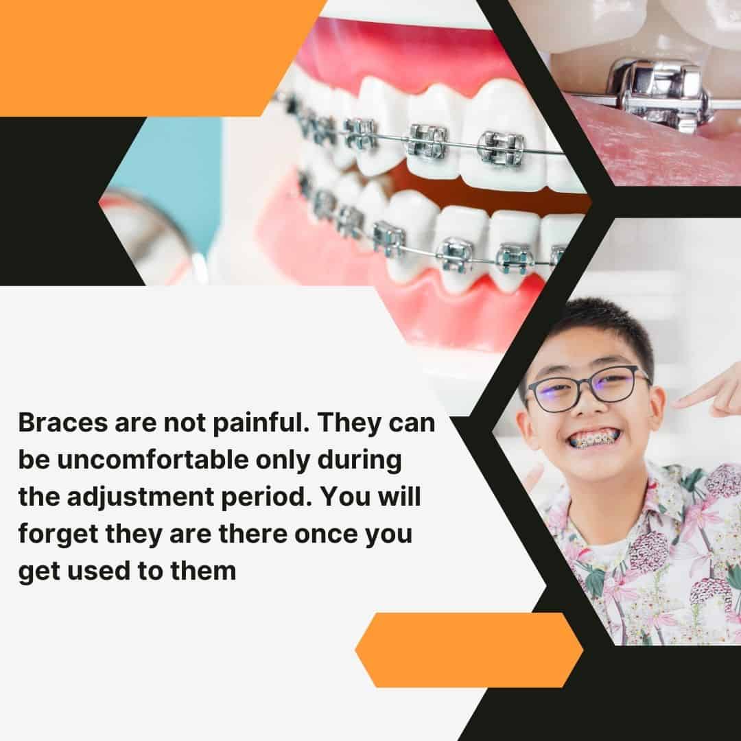 braces are not painful but can cause pain if right food is not taken