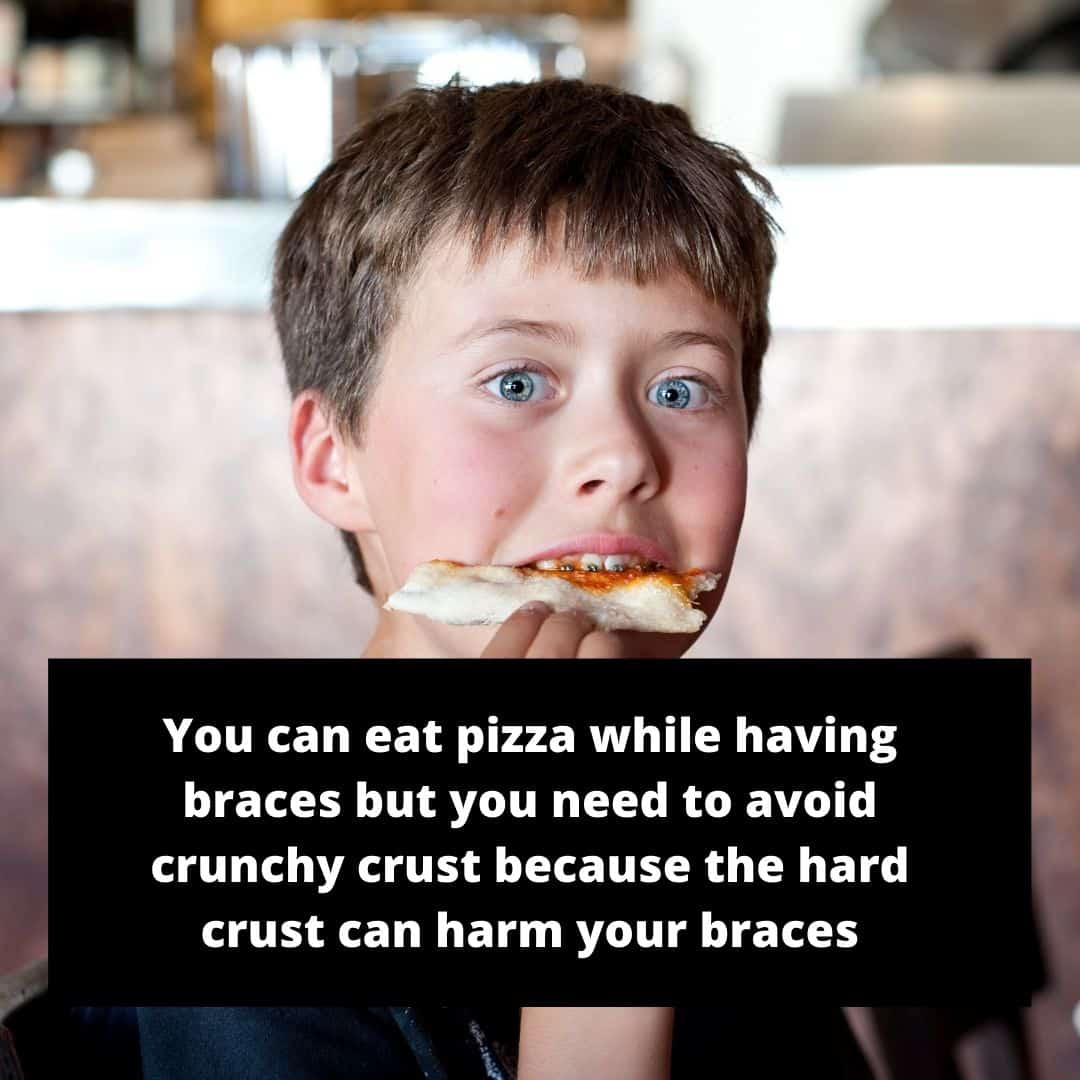 12 Fast Foods to Eat with Braces Without Causing Pain