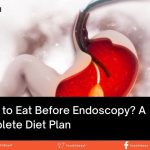 What to Eat Before Endoscopy A Complete Diet Plan
